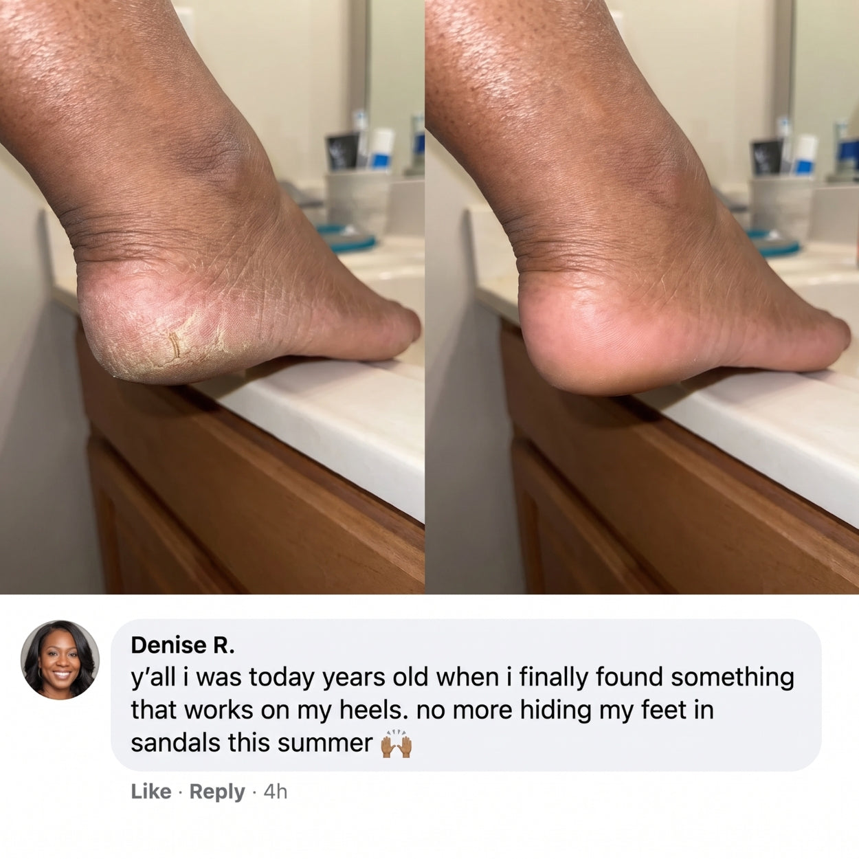 Lanira Pure Feet Care Stick