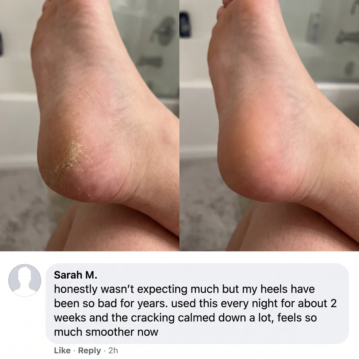 Lanira Pure Feet Care Stick
