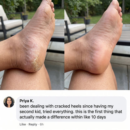 Lanira Pure Feet Care Stick