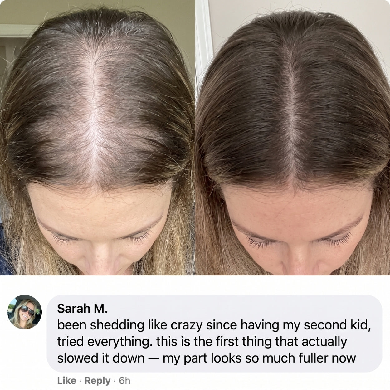 Lanira Hair Revival Serum With Built-In Brush