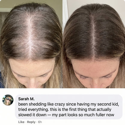 Lanira Hair Revival Serum With Built-In Brush