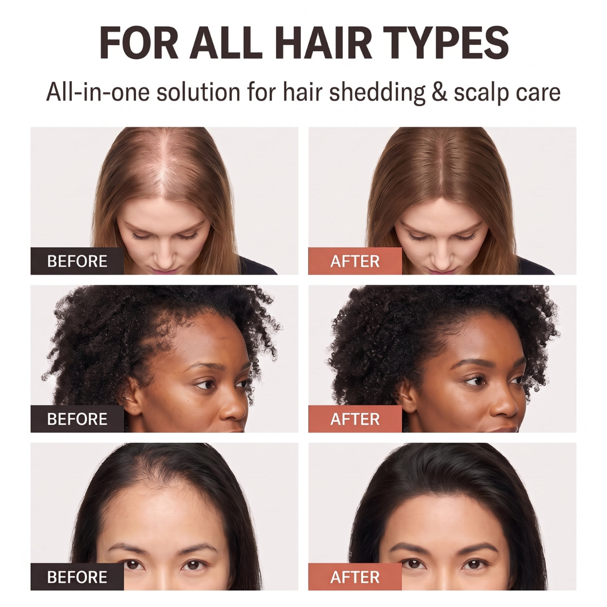 Lanira Hair Revival Serum With Built-In Brush