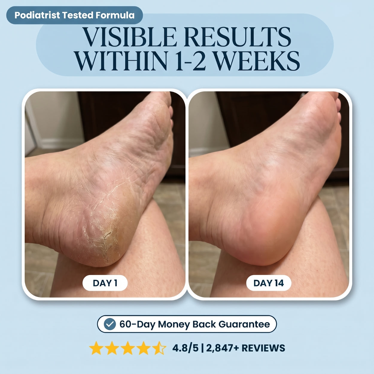 Lanira Pure Feet Care Stick