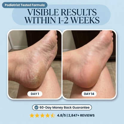 Lanira Pure Feet Care Stick