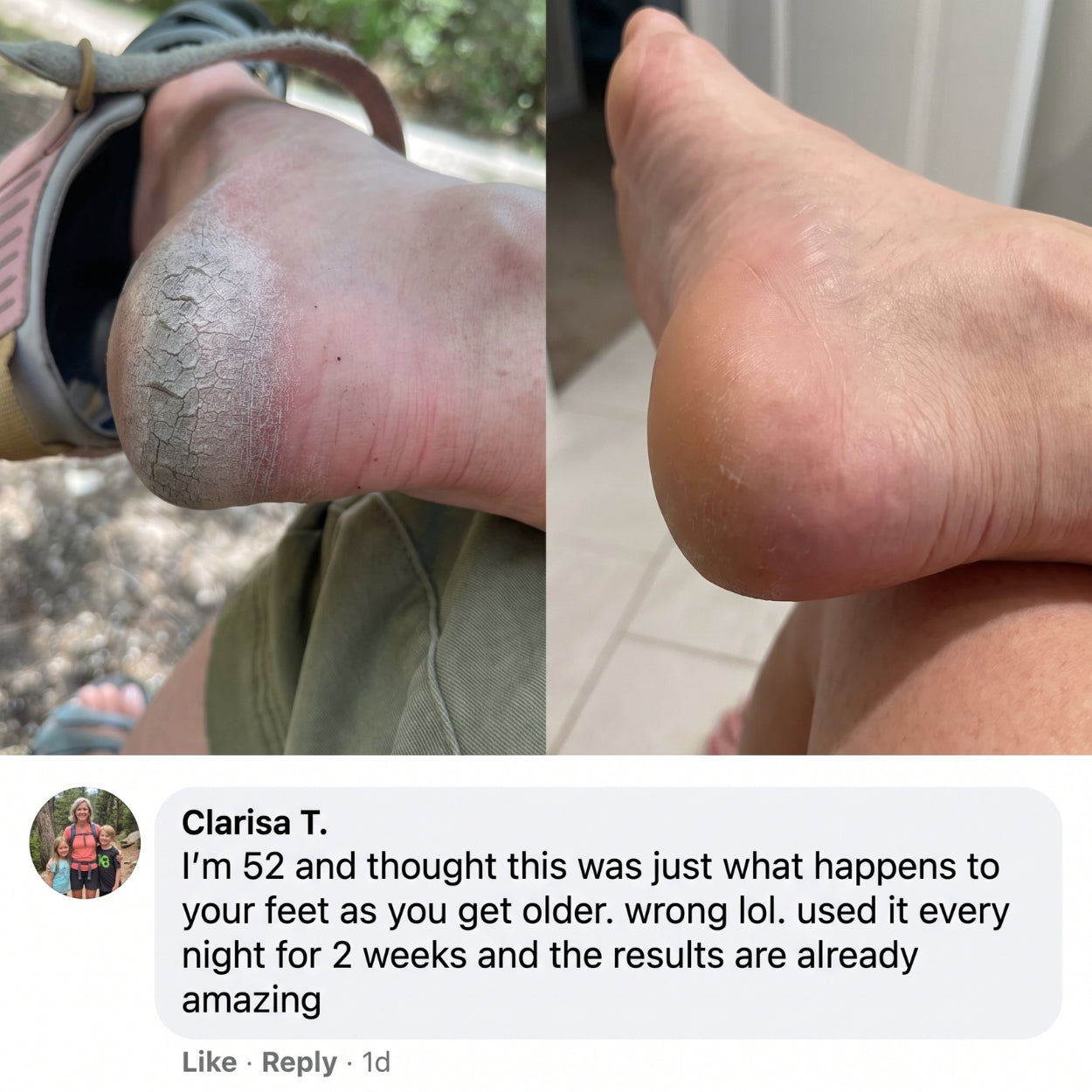 Lanira Pure Feet Care Stick